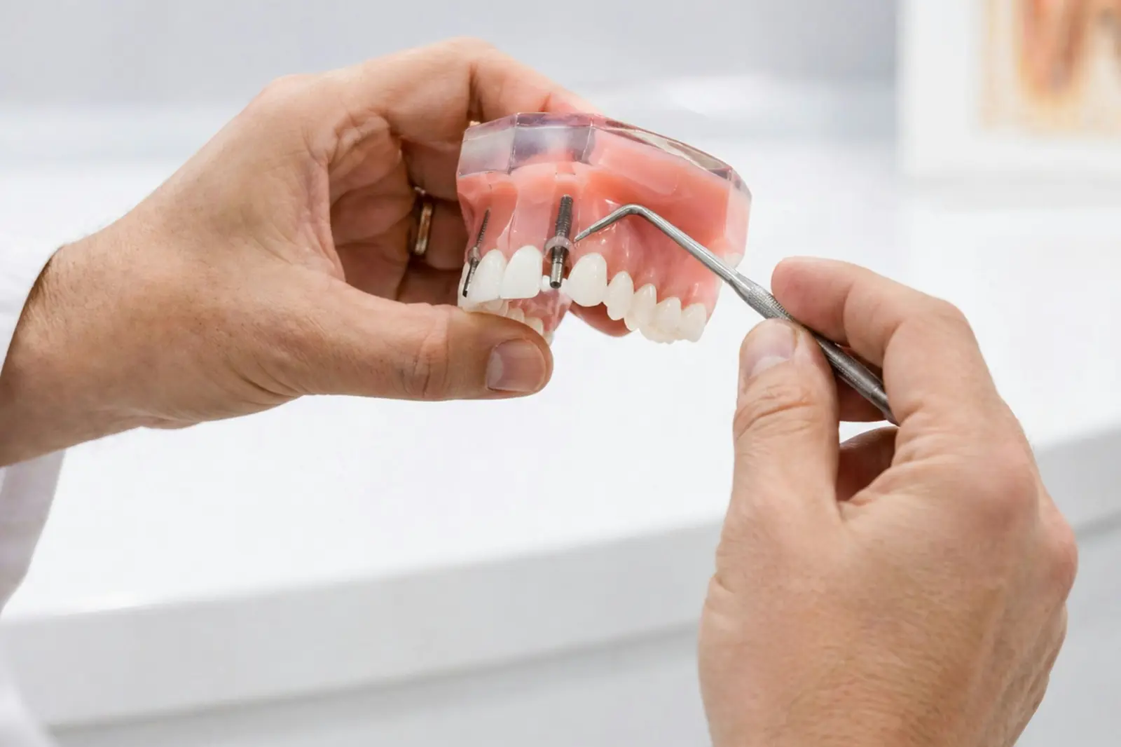 A dental model of the upper and lower teeth held in one hand, examined with a probe