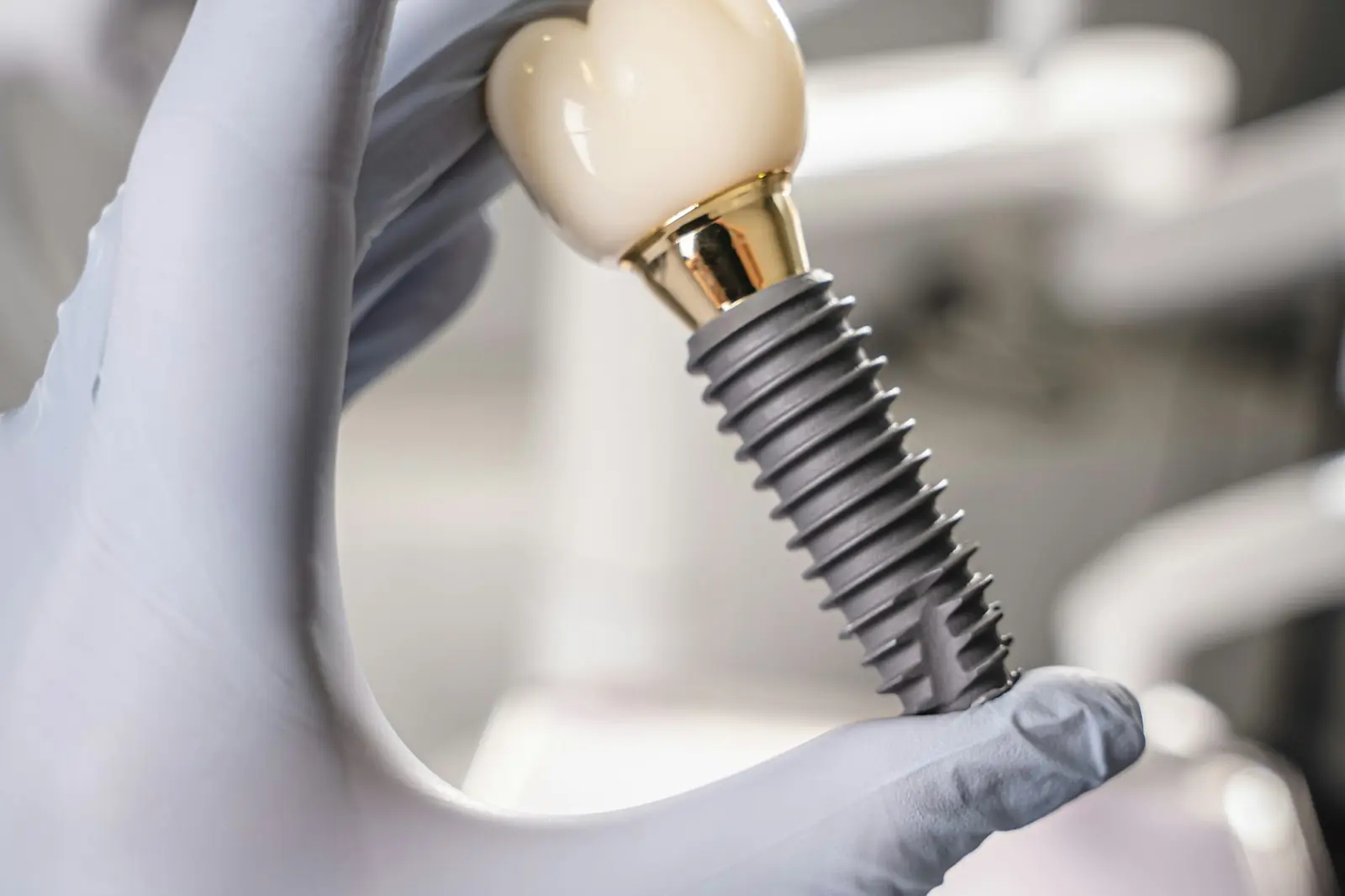 A gloved hand holding a dental implant fitted with a crown
